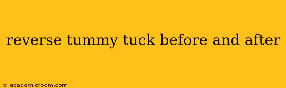 reverse tummy tuck before and after