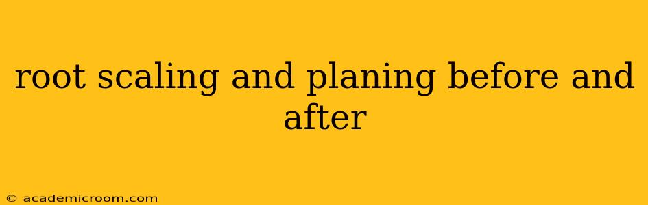 root scaling and planing before and after