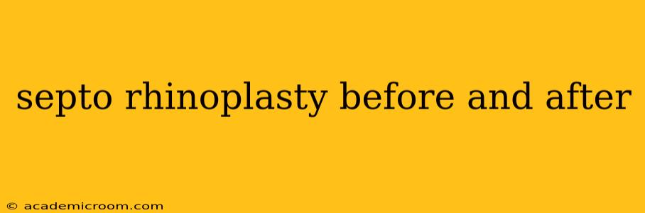 septo rhinoplasty before and after