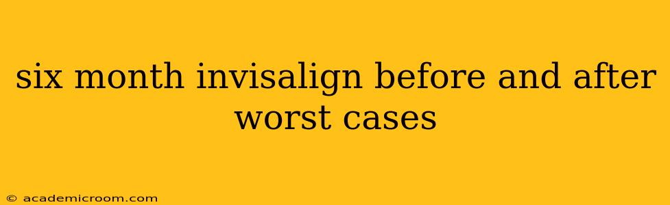 six month invisalign before and after worst cases