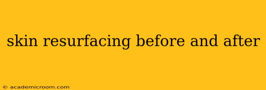 skin resurfacing before and after