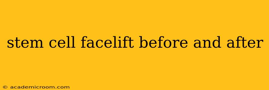 stem cell facelift before and after