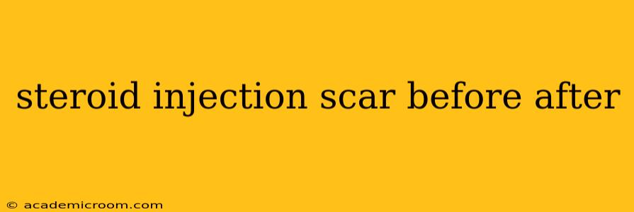 steroid injection scar before after