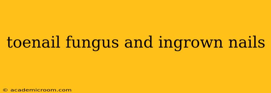 toenail fungus and ingrown nails