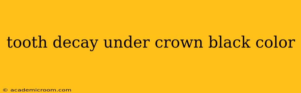 tooth decay under crown black color