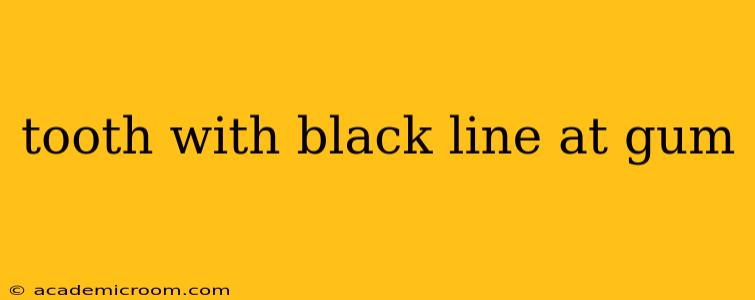 tooth with black line at gum