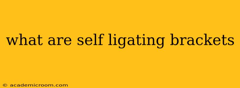 what are self ligating brackets