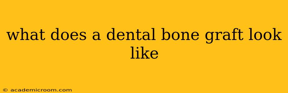 what does a dental bone graft look like