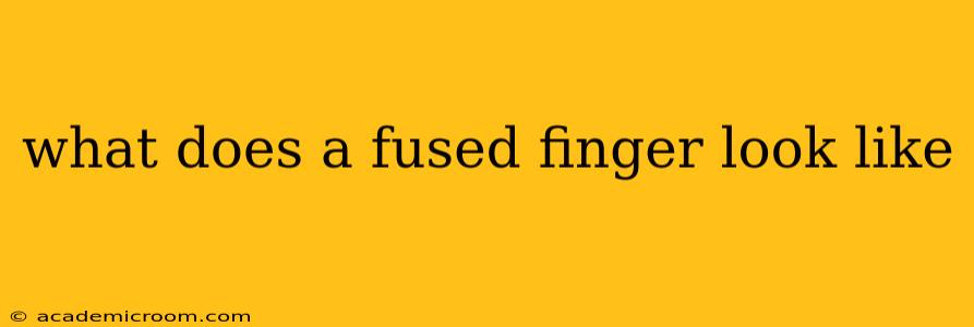 what does a fused finger look like