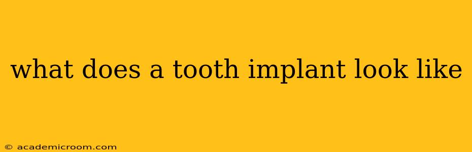 what does a tooth implant look like
