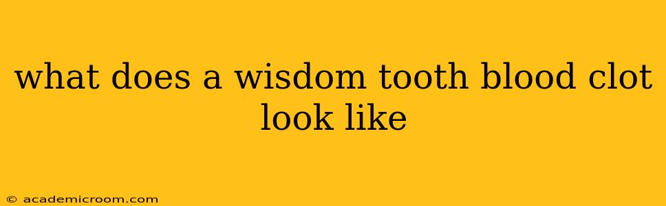 what does a wisdom tooth blood clot look like