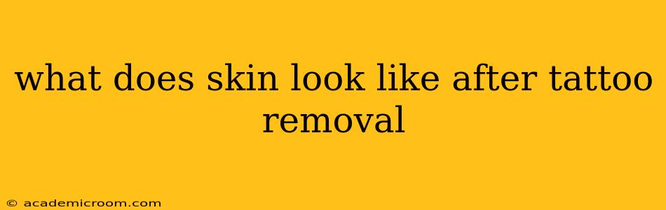 what does skin look like after tattoo removal