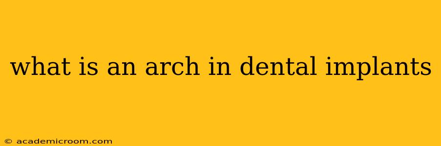 what is an arch in dental implants