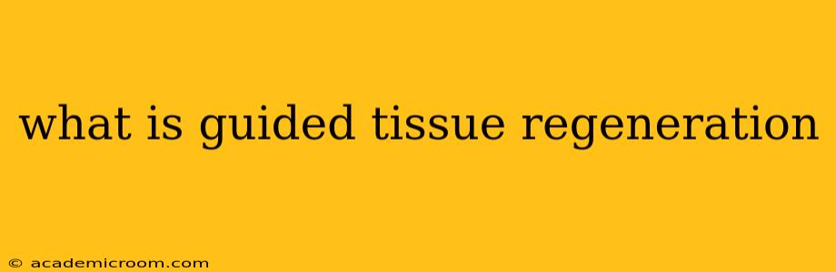 what is guided tissue regeneration