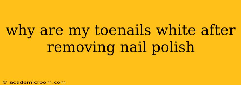 why are my toenails white after removing nail polish