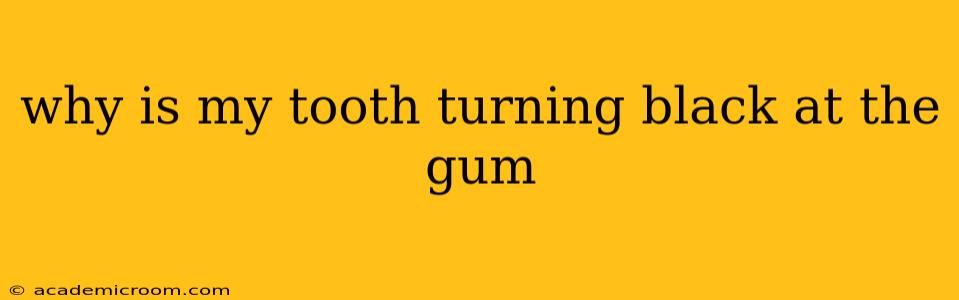 why is my tooth turning black at the gum