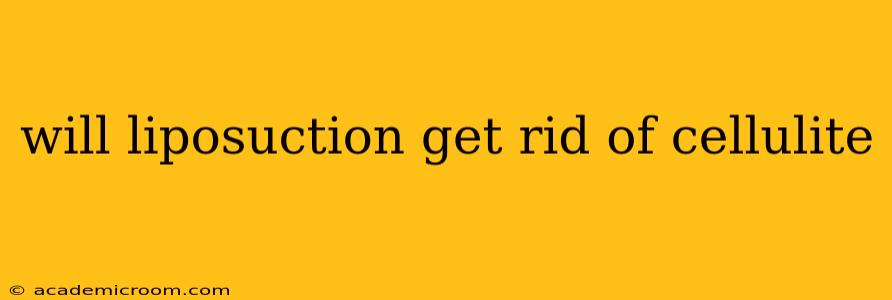 will liposuction get rid of cellulite