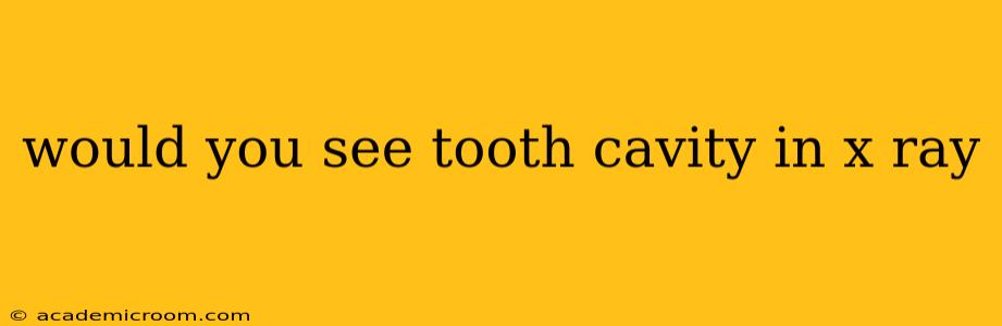 would you see tooth cavity in x ray